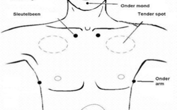 Emotional Freedom Technique / EFT